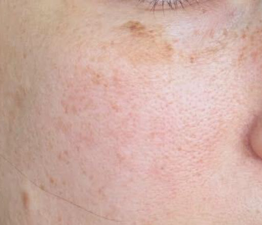 Photo from customer review