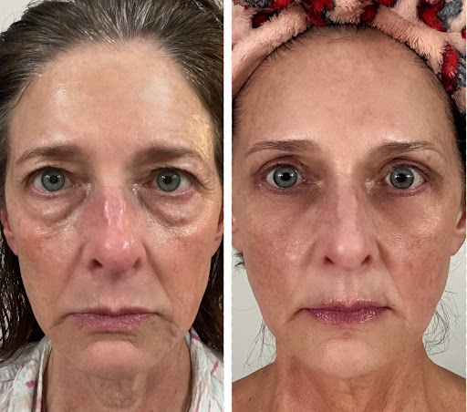 Photo from customer review